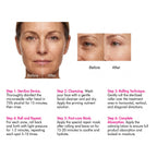 Derma Roller