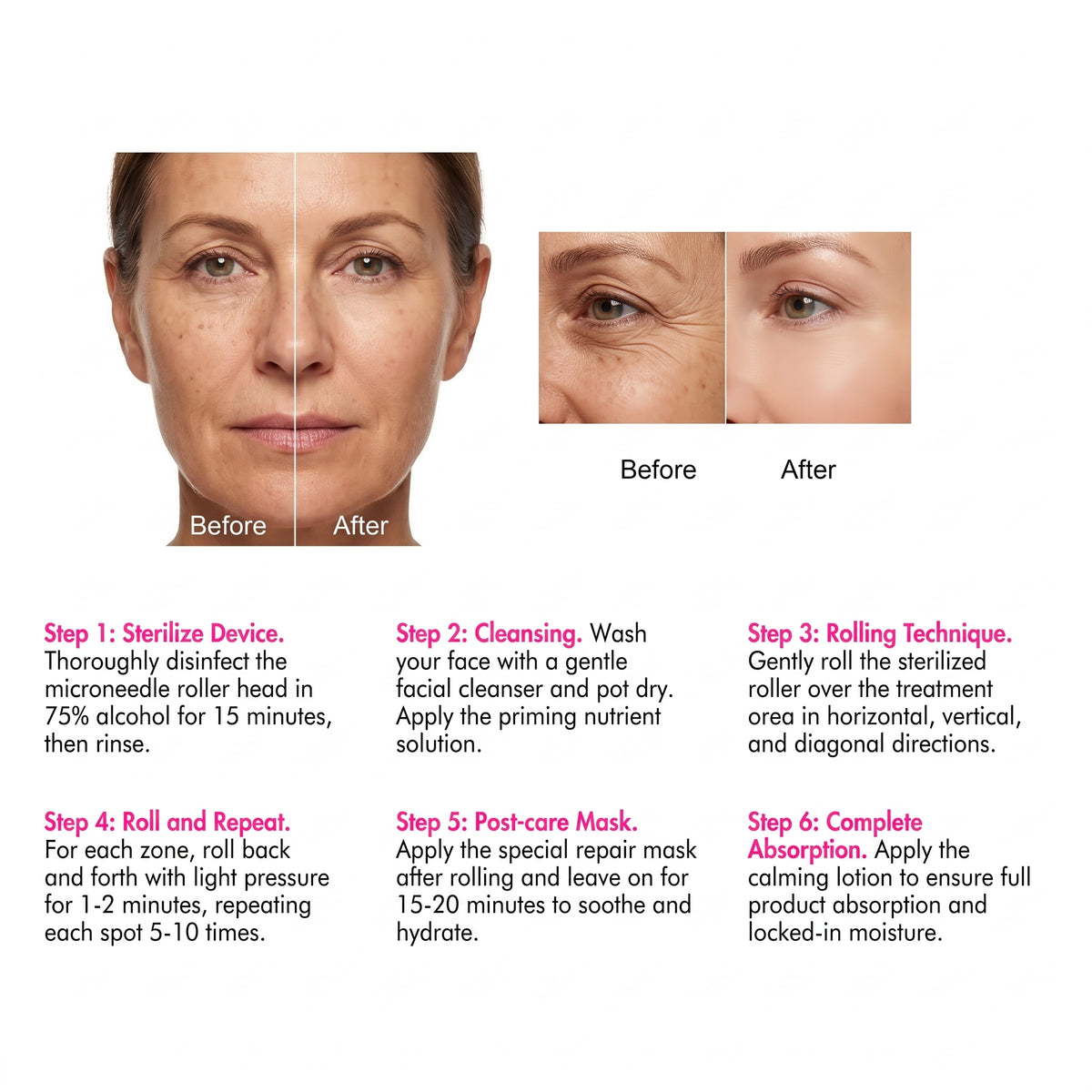 Derma Roller