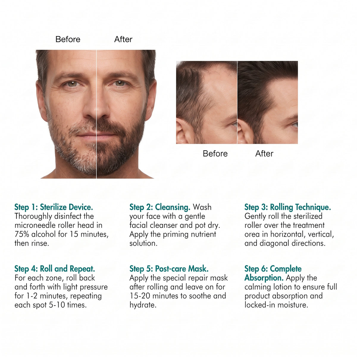 Derma Roller Men